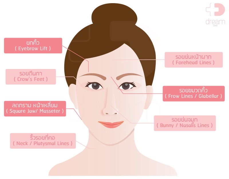 Botulinum Toxin