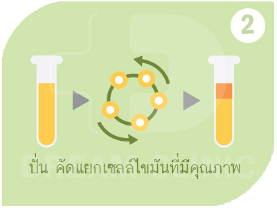 เสริมหน้าอกด้วยไขมันตัวเอง