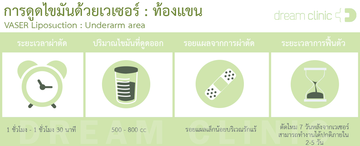 ดูดไขมันต้นแขนด้วยเวเซอร์