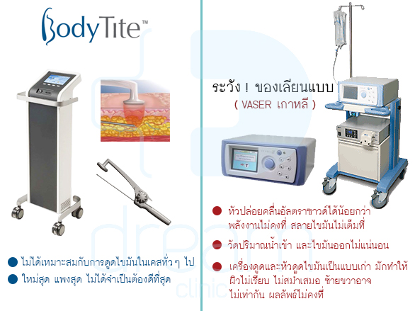 ระวังของเลียนแบบ