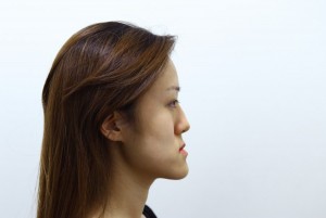 ฝาแฝดสาวเกาหลีศัลยกรรมใหม่จนสวยอย่างกับนางฟ้า - Dream Clinicdream