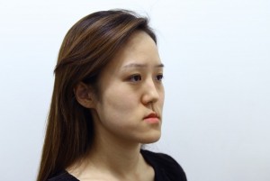 ฝาแฝดสาวเกาหลีศัลยกรรมใหม่จนสวยอย่างกับนางฟ้า - Dream Clinicdream