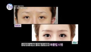 ฝาแฝดสาวเกาหลีศัลยกรรมใหม่จนสวยอย่างกับนางฟ้า - Dream Clinicdream