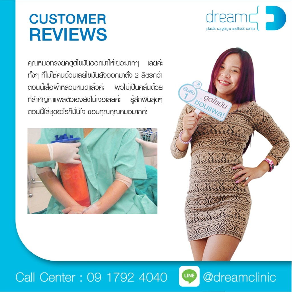 vaser dream clinic ซ่อนแผล ดูดไขมัน  6S