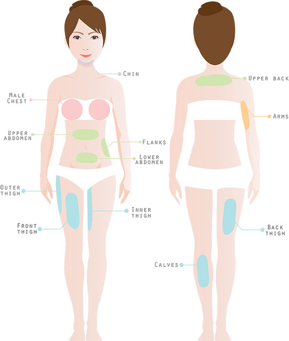 Vaser Liposelection Area