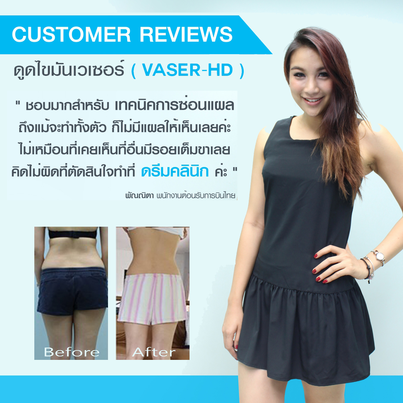 vaser testimonial before after หมอทรงยศ dream