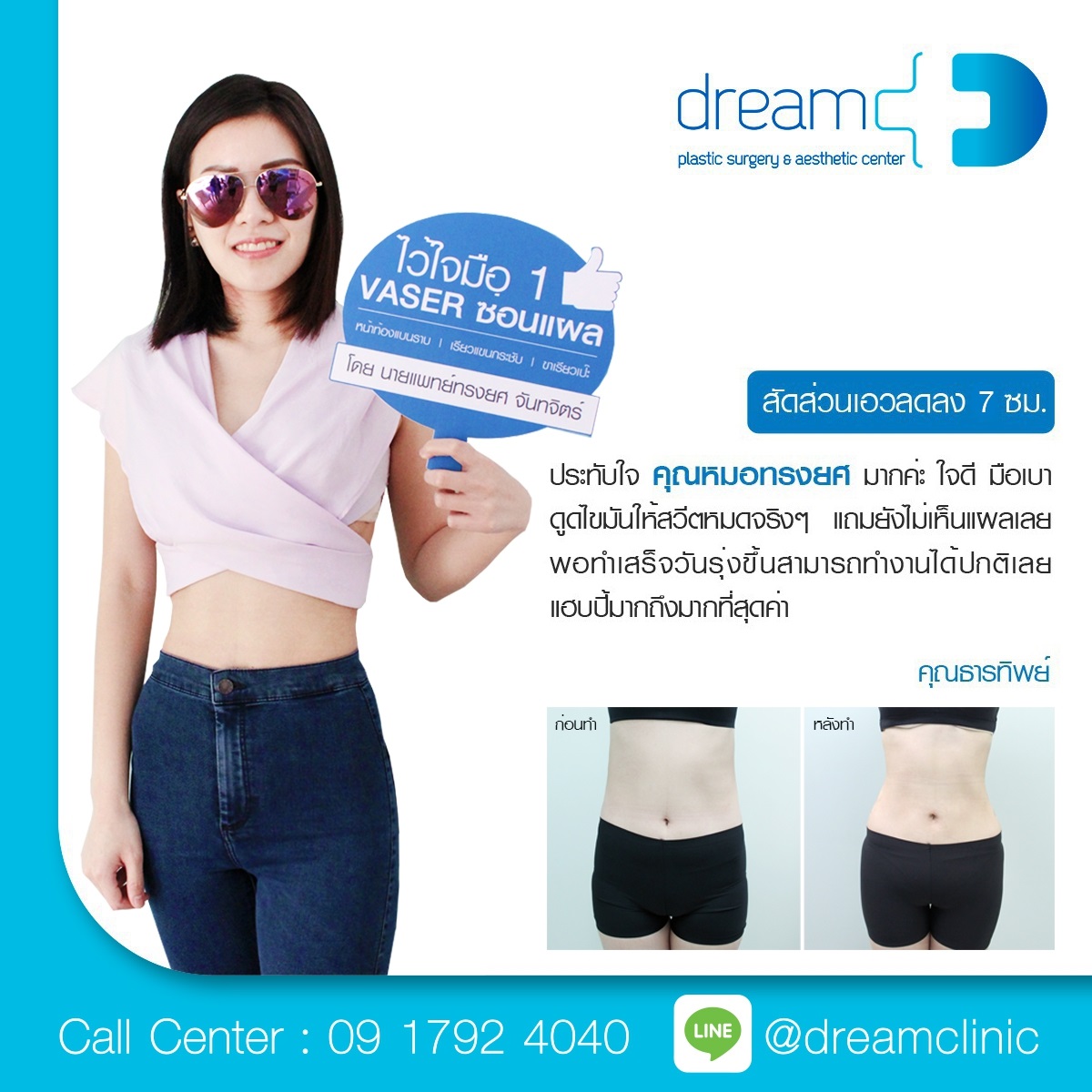 vaser ซ่อนแผล dream clinic หมอทรงยศ 