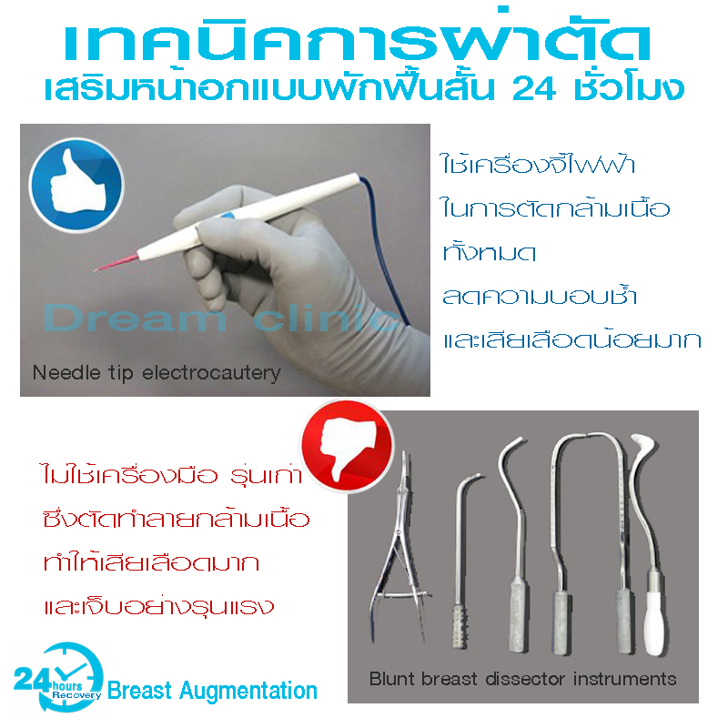 เสริมหน้าอก พักฟื้นสั้น 24 ชั่วโมง 1 วัน หมอทรงยศ dream clinic