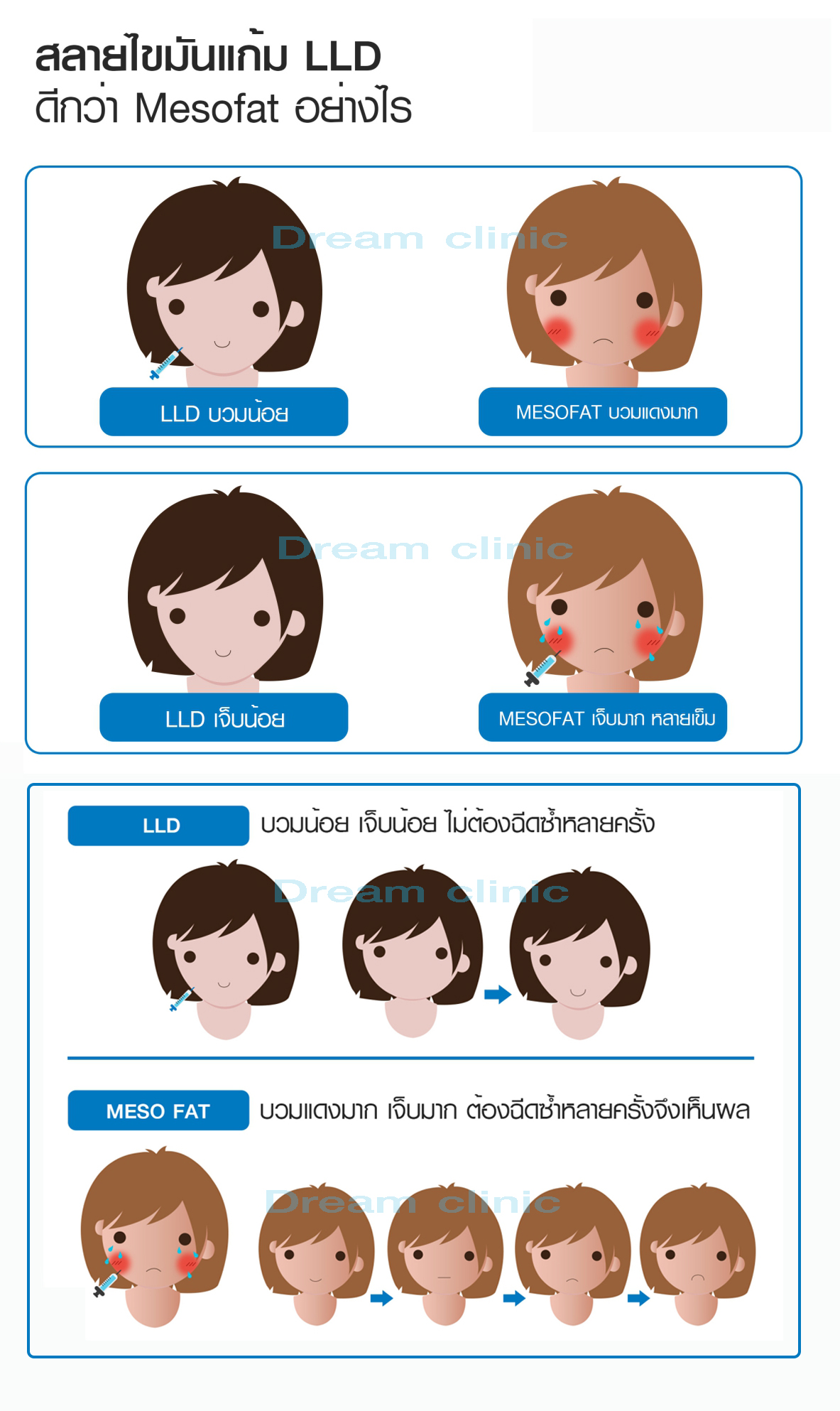 LLD ดีกว่า Mesofat ฉีดสลายไขมัน หน้าเรียว ลดแก้ม V-shape dream clinic