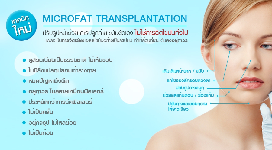 ปลูกถ่ายไขมัน microfat transplantation