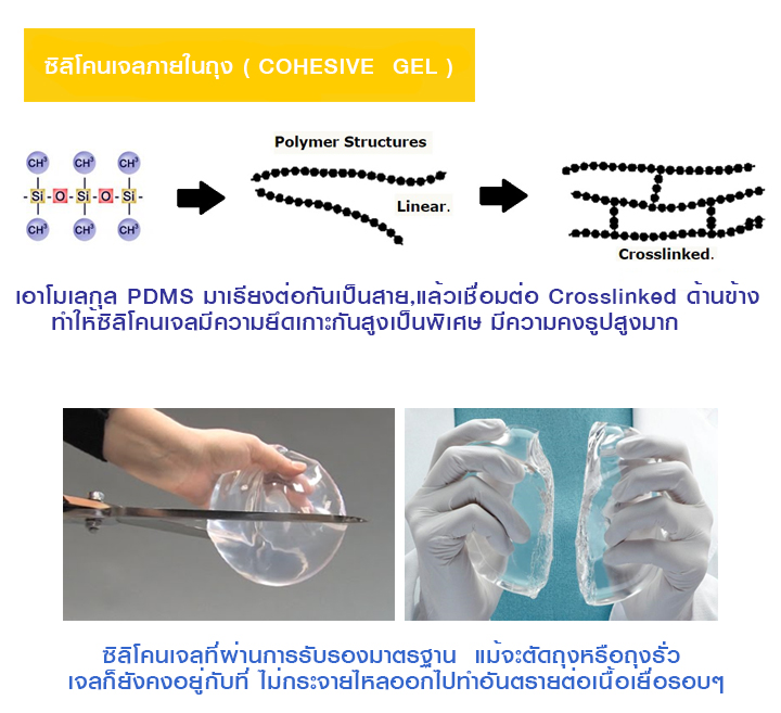 cohesive gel