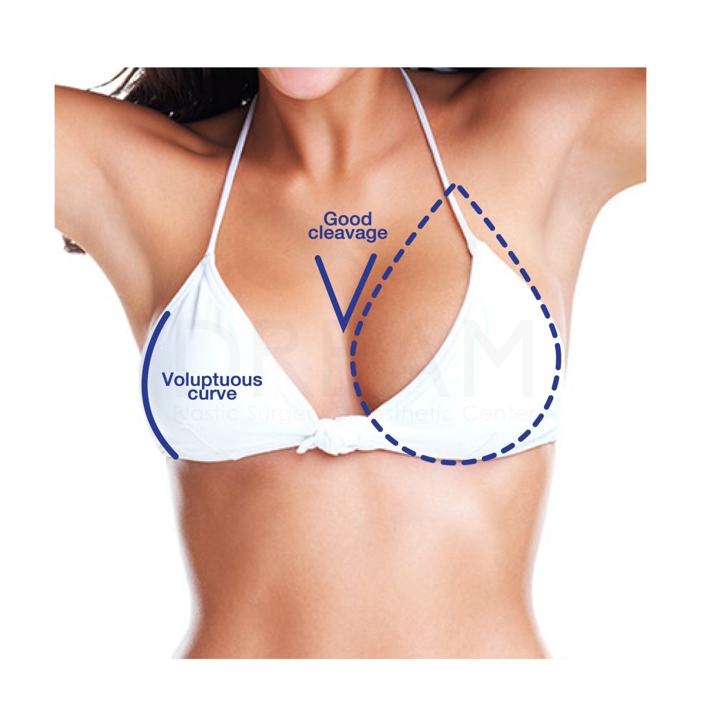 perfect breast 2, dream clinic