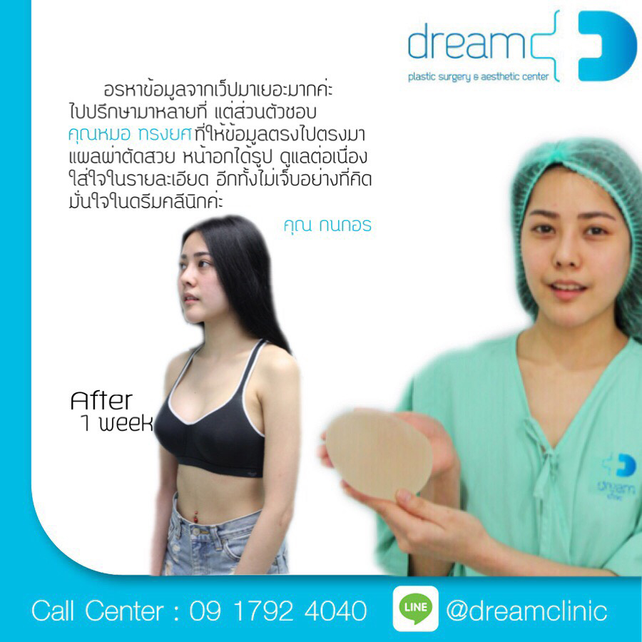 เสริมหน้าอก หมอทรงยศ dream clinic