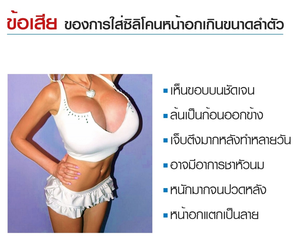 ข้อเสียการใส่ซิลิโคนเกินขนาด