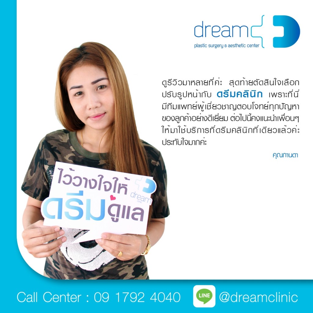 v-shape ปรับหน้าเรียว Botox LLD dream clinic