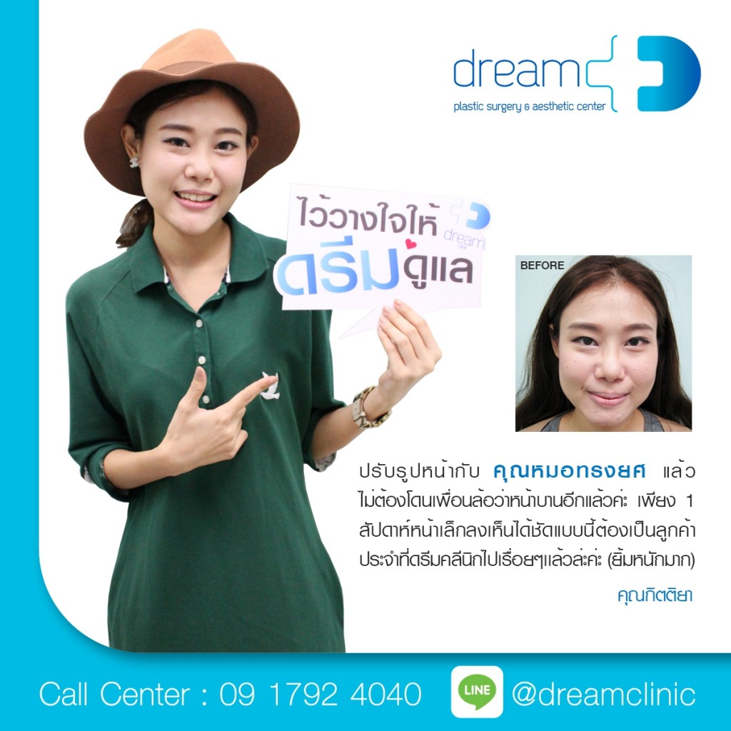 ปรับรูปหน้าเรียว หมอทรงยศ ดรีมคลินิก