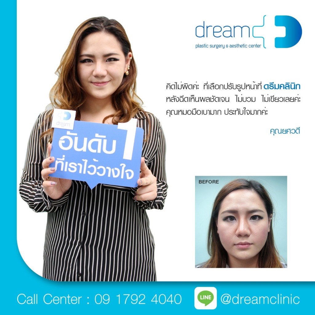 botox ลดกราม LLD ปรับหน้าเรียว V-shape ดรีม dream clinic