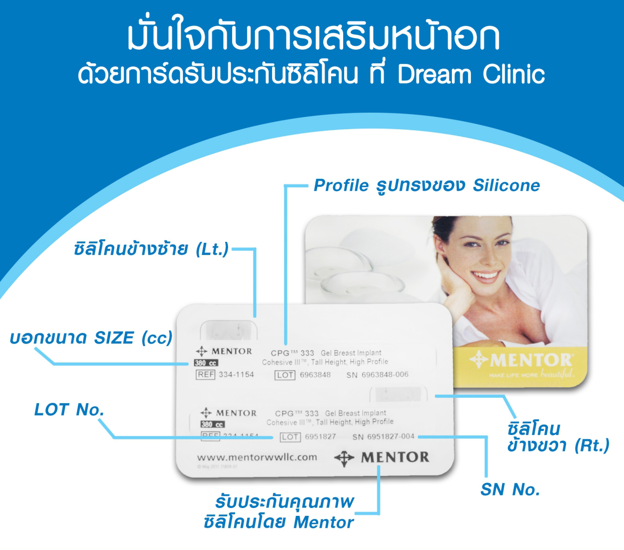 บัตรประจำตัวเสริมหน้าอก Mentor dream clinic บัตรรับประกันคุณภาพ