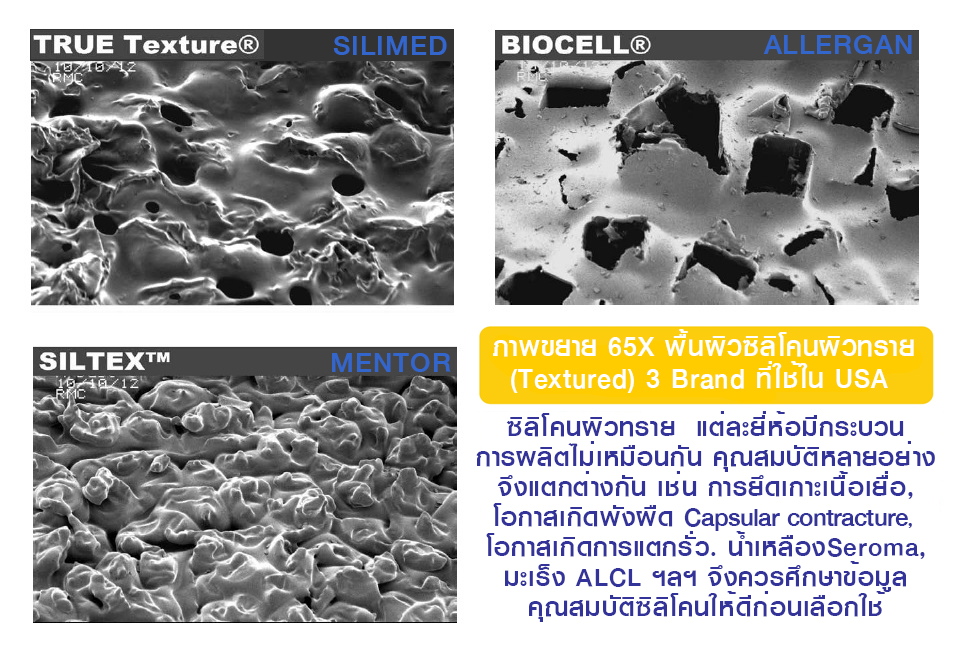 พื้นผิวซิลิโคน textureสามยี่ห้ออเมริกาUSA