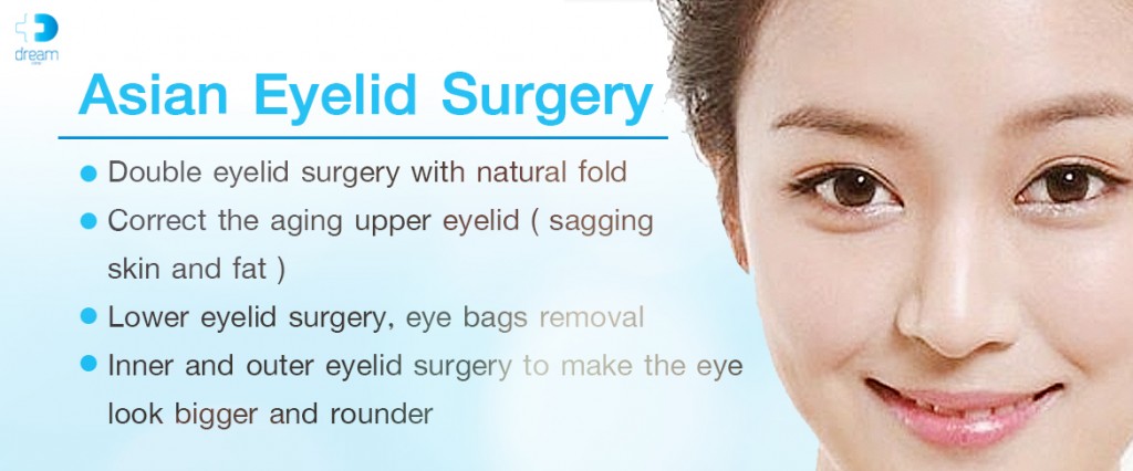 eye surgery