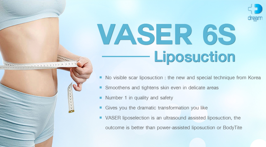 vaser liposuction