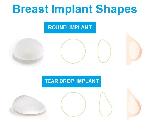 breast implant shapes